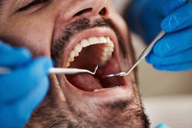 Best Broken or Cracked Tooth Emergency Dentist in South Amherst, OH