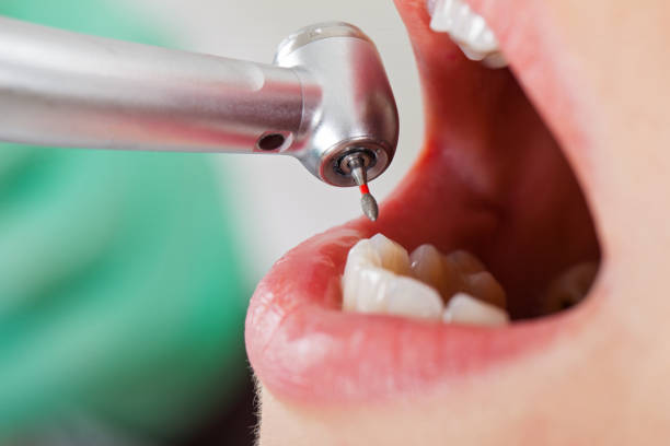 Best Emergency Cosmetic Dentistry in South Amherst, OH
